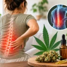 Medical Cannabis for Back Pain